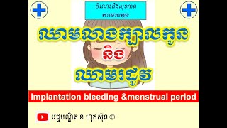 ឈាមលាងក្បាលកូននិង ឈាមរដូវ l Implantation bleeding and menstrual period l វេជ្ជបណ្ឌិត ខ ហុកស៑ុន