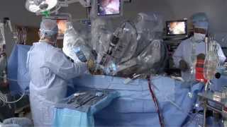 Laparoscopic vs. Robotic