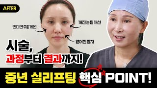 중년 실리프팅의 핵심 POINT ‼ 시술 과정부터 결과까지 전.격.공.개 ‼