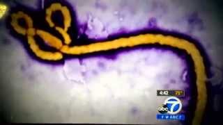 Dr. Janesri De Silva speaking about Ebola on ABC7 Los Angeles