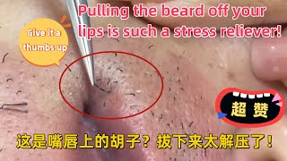 【震惊我了】把嘴唇上的胡子拔下来，真的太爽了！真解压！Pulling your beard is such a stress reliever!