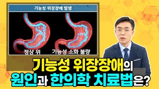 잦은 위장병의 원인은 무엇일까? 노기환 원장