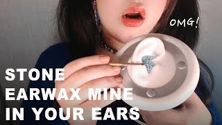 ASMR Intense Stone Earwax Cleaning for Tingles Immunity 1H