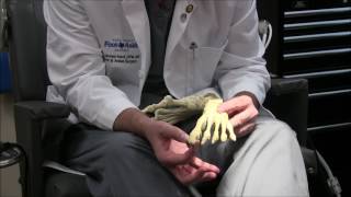 Silver Bunion Surgery Explained