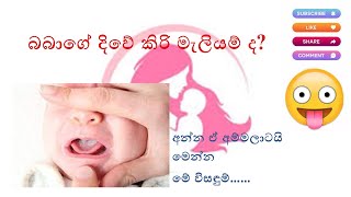 ඔබේ බබාත් කිරි මැලියම් නිසා කිරි බොන්න හොරද?(Baby Tongue Cleaning)