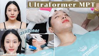 สวยยันคอมีอยู่จริง! พาไปทำ Ultraformer MPT อยากหน้ากระชับต้องทำที่คอ!? | widpim withpim