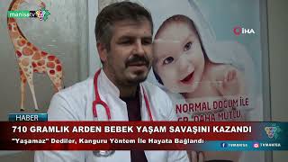 710 GRAMLIK ARDEN BEBEK YAŞAM SAVAŞINI KAZANDI