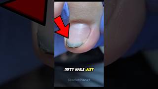 What S Really Under Your Fingernails Microscope Nails