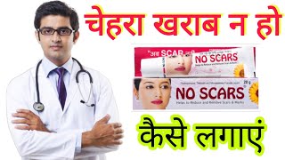 No Scars cream review in hindi | roop Mantra cream results, benefits, uses, price info