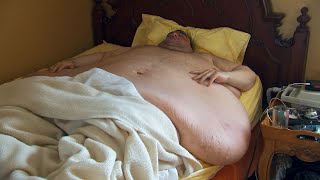 This Extremely Overweight Man Relies On His Fiancée For Everything