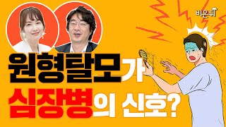 원형탈모가 있으면 심혈관질환의 확률이 높다?  (분당서울대병원 피부과 신정원 교수)