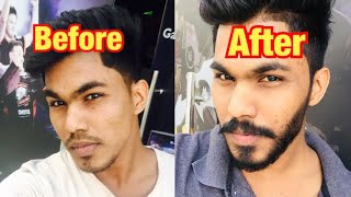 താടി വളരാൻ എന്ത് ചെയ്യണം | How to Grow Beard Faster