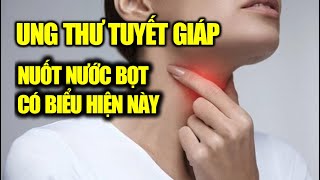 Nuốt nước bọt mà có dấu hiệu này, có khả năng bị ung thư tuyến giáp | Cuộc Sống Hạnh Phúc