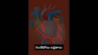 గుండెపోటు లక్షణాలు/Heart Attack Symptoms