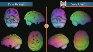 How to Promote Brain Health | Dr. Daniel Amen