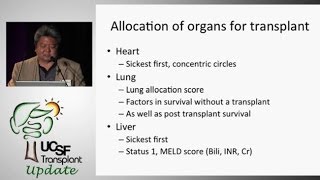 Optimizing the Match Between Deceased Donors and Recipients - UCSF Kidney Transplant Program -