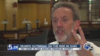 Mumps outbreak in Ohio