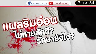 เป็นแผลริมอ่อน ไม่หายสักที ?  - ชูรักชูรส ep 954