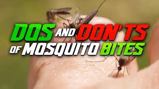 Tips for Soothing a Mosquito Bite