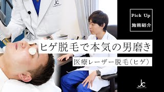 【施術紹介】ヒゲ脱毛を本気でお考えの方、ぜひ見てください。