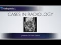 Cases in Radiology: Episode 2 (abdomen, CT)