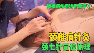 针灸教学：中医颈七针治疗颈椎病，关键原理是什么？一分钟看懂 #中医 #中医文化 #中医科普 #中医问诊