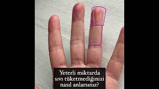 Yeterli Miktarda Sıvı Tüketmediğinizi Nasıl Anlarsınız? #sağlık