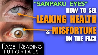"Sanpaku Eyes" - How To See Health Depletion & Misfortune On The Face