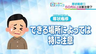 【いっちゃん☆メディコ】帯状疱疹①５０代以上は要注意？