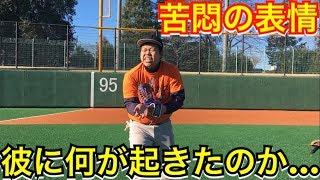 【野球部人工芝野球場あるある】ダイビングで皮膚が焼けちゃうヤツ…