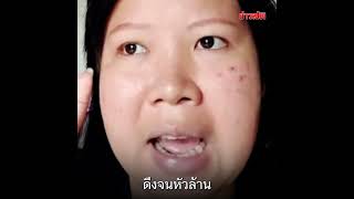 สาวช้ำ ป่วยดึงผมตัวเอง เป็นมา 15 ปี ใช้ชีวิตเยี่ยงคนปกติไม่ได้ : Khaosod TV