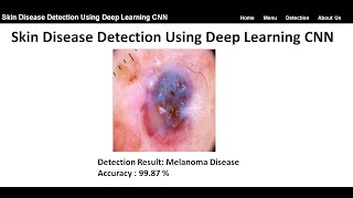 Skin Disease Detection Using Deep Learning CNN | Python Project | Skin Disease Classification Python