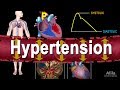 Hypertension - High Blood Pressure, Animation