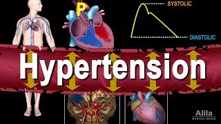 Hypertension - High Blood Pressure, Animation