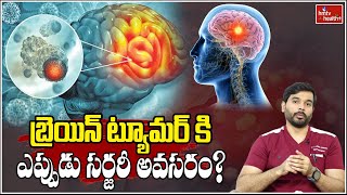 బ్రెయిన్ ట్యూమర్ కి ఎప్పుడు సర్జరీ అవసరం? l When does brain tumor require surgery l hmtv Health