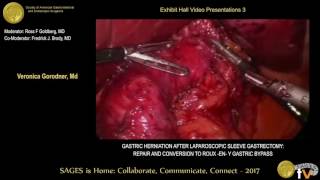 Gastric herniation after laparoscopic sleeve gastrectomy: Repair \u0026 conversion to RYGB