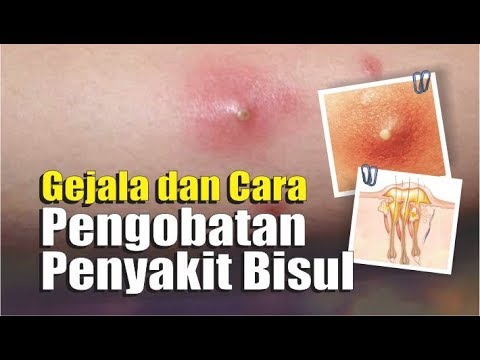 Gejala Dan Cara Pengobatan Penyakit Bisul | @TRIBUNLAMPUNGNEWSVIDEO ...