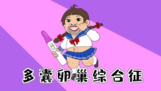 医学记忆漫画 |【多囊卵巢综合征】诊断标准（如花版）