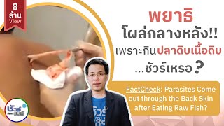 ชัวร์ก่อนแชร์ : พยาธิโผล่กลางหลัง เพราะกินปลาดิบเนื้อดิบ จริงหรือ ?