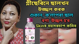 গ্লীছেৰিন এইদৰে লগাব Skinৰ পৰা বয়সৰচাপ ক'লাদাগ শুকান ছাল দুৰ হ'ব Skin উজ্বল বগা Spotless হ'ব | vlog