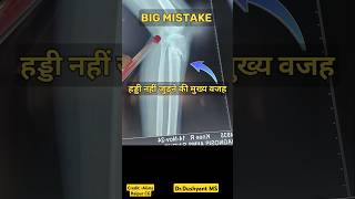 WHY Bone Failed To Unite🔥 मुख्य कारण 💥#fracturerecovery #fracturehealing #fracture