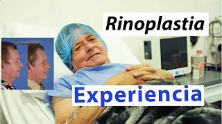 Rhinoplasty experience of a 68 year old gentleman