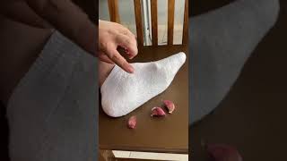 Place 1 clove of garlic on your feet and you won't believe the results! #fypシviral #viralvideo