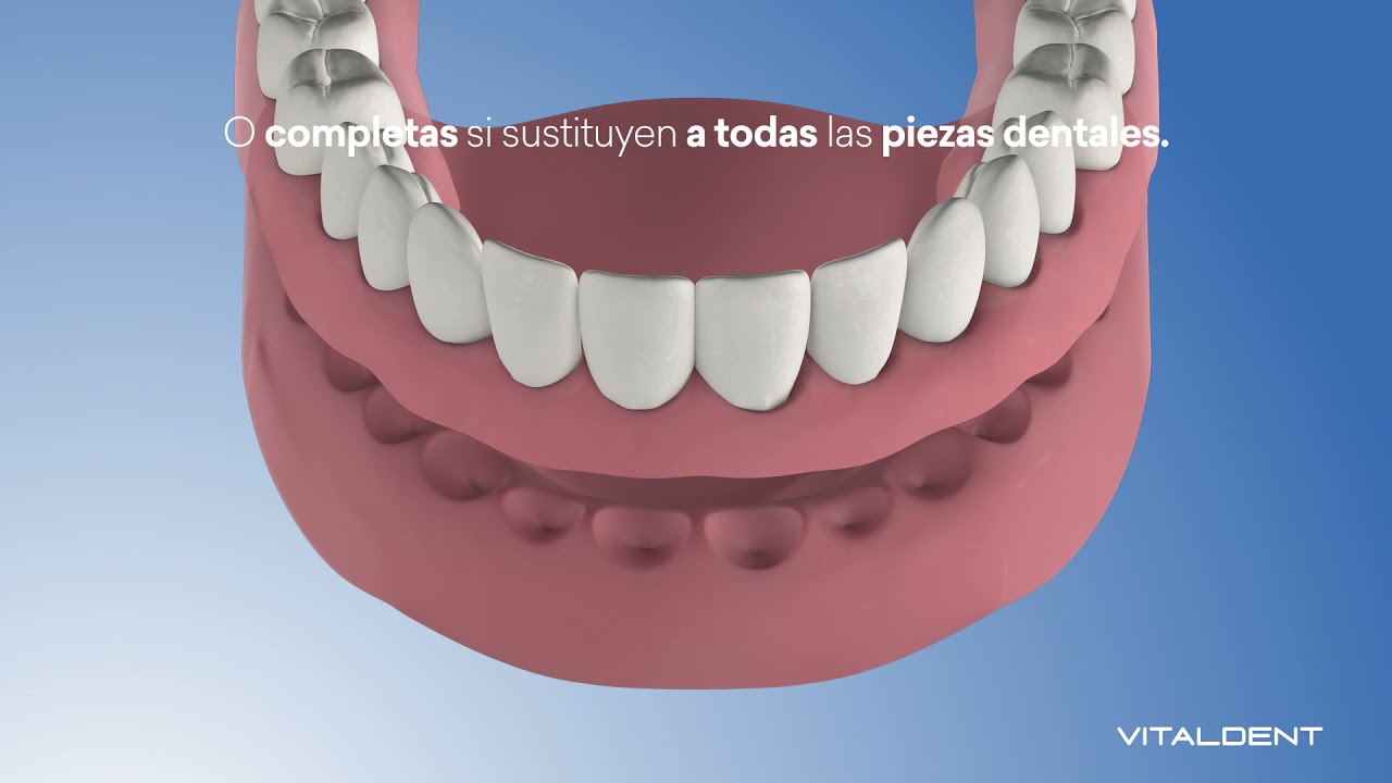 Prótesis Dental Removible - Vitaldent - YouTube