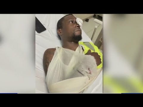 Man Accused Of Beating MTA Worker In The Bronx Set To Face Judge - YouTube