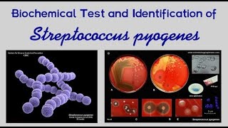 Pharyngitis, Part 2; Bacterial Pharyngitis, Streptococcus Pyogenes