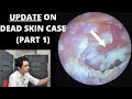 UPDATE On Rapid Skin Shedding Case (Part 1)