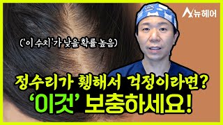 정수리 탈모 고민, 이것 보충해서 드셔보세요!ㅣ뉴헤어