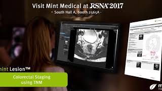 Visit Mint Medical at RSNA 2017