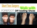 After Brachymetatarsia Surgery Walk || Using modified DARCO Forefoot Offloading Shoes/ Dr. Khaqan